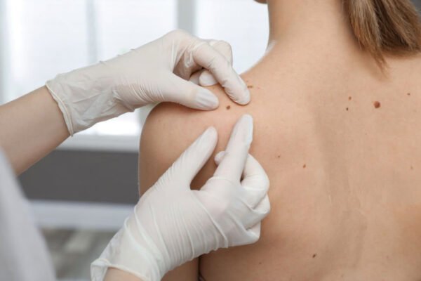 Dermatologist
