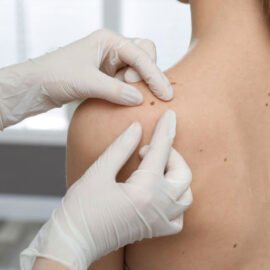 Dermatologist