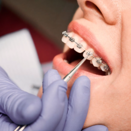 Orthodontist